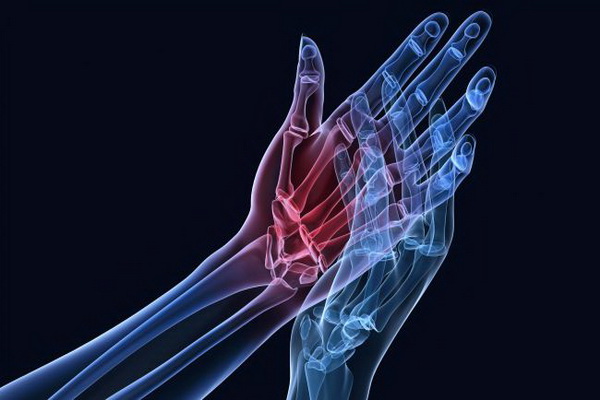 Donosimo vježbe za smanjenje bolova u ručnim zglobovima - tophome-remedies.com