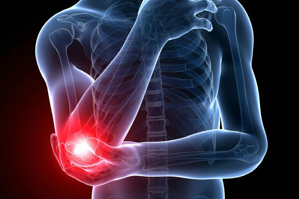 liječenje bursitisa koljena s artrozom bol u kostima bol u zglobovima