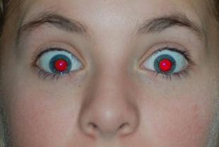 Zašto nedostatak crvenih očiju na fotografijama može biti znak ozbiljnog zdravstvenog problema