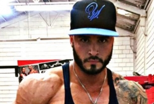 Muškarac koji je koristio steroide deset godina otkrio ozbiljan i neočekivan neželjeni efekat