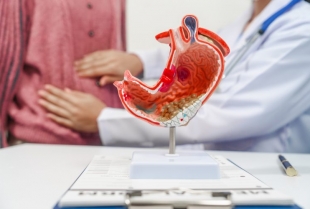 Gastroenterolog upozorava: Ovih pet ranih simptoma raka želuca ljudi najčešće ignorišu